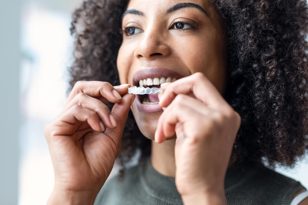 Young woman inserting a clear, discreet orthodontic aligner from Clearly Dental Dapto.
